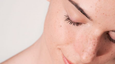 Skin barrier role Skin barrier role